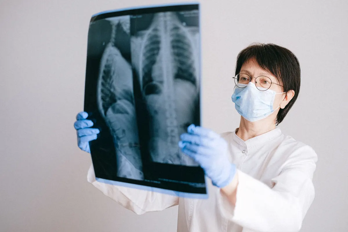 Profesional de la salud con mascarilla y guantes revisando una radiografía de tórax a contraluz