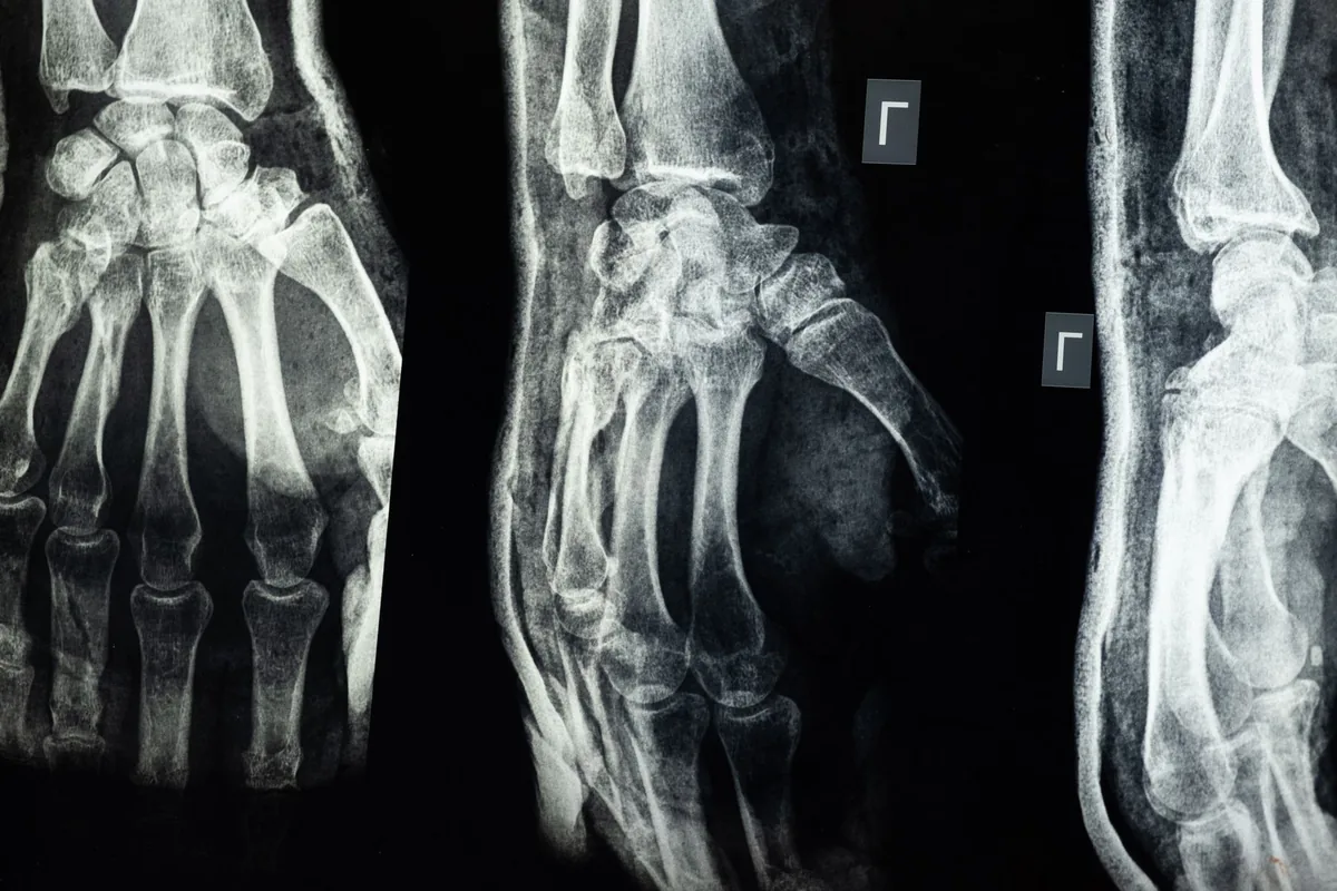 Veterinario revisando una radiografía digital de un perro en la pantalla de la clínica